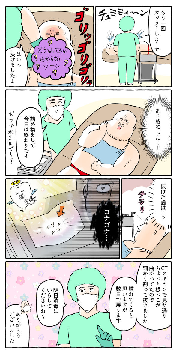 【歯】下の親知らず抜いた話③ 