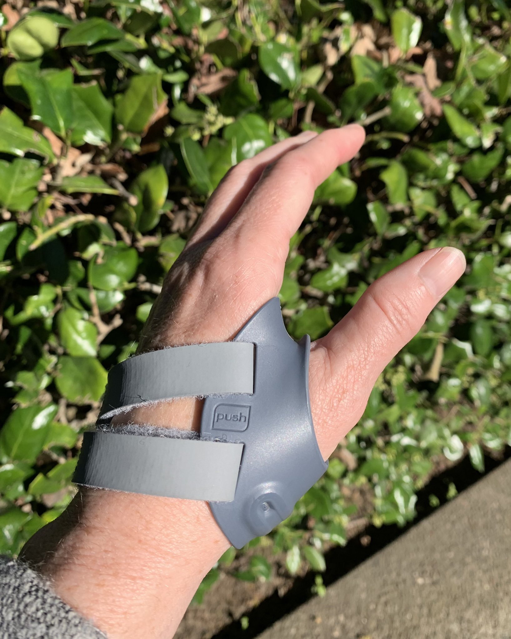 Catherine Curtin Each Specialty Has A Unique Sign When You Know You Are Getting Old Hand Surgeons Painful Cmc Joint What Is Yours Medtwitter Handsurgery T Co 8skurl4dyq Twitter