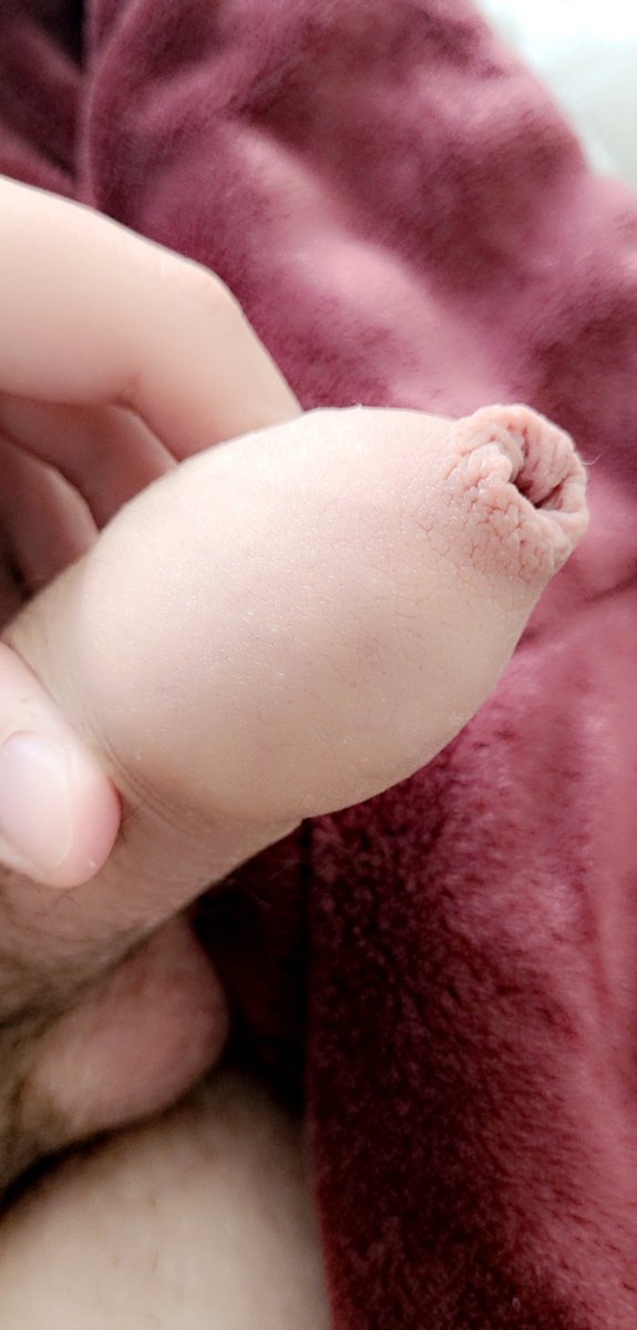 IntactAndy's tweet image. Do you think foreskin is ugly?