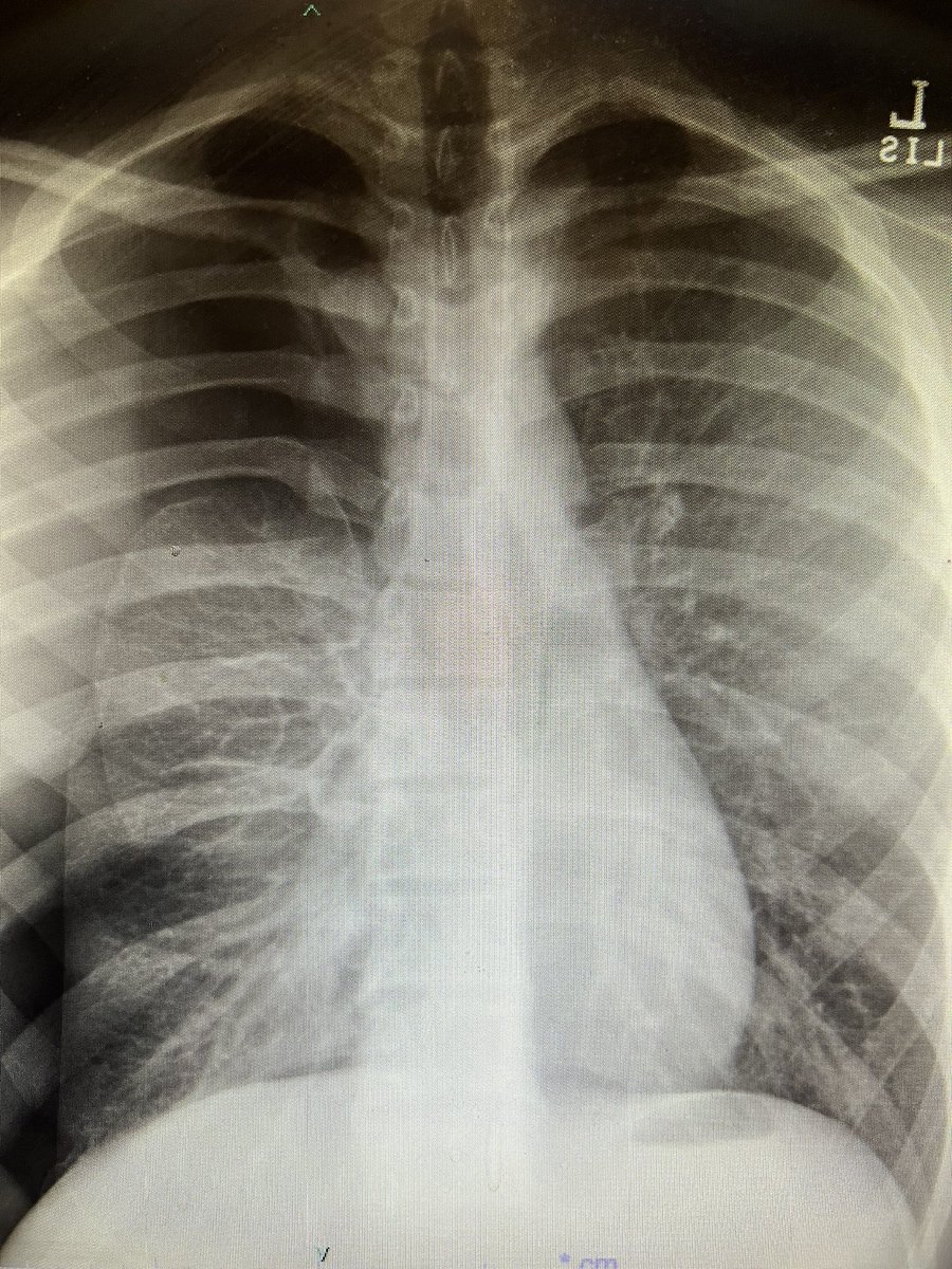 MBeasleyMD's tweet photo. Saturday sports clinic 
CC: low back pain 
“Oh I also have this weird like rib and shoulder pain recently, almost makes me feel short of breath…” https://t.co/e9UPn4oIax