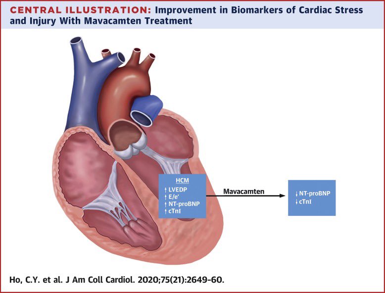 SABOURETCardio's tweet photo. My choices for #ACC22 1. #Mavacamtem in #HCM 2.#SGLT2I with #Sotagliflozin 3.#Bentracimab in elderly both trials presented by @DLBHATTMD 4. FAME3 and #QOL 5. #pacman-MI #PCSK9i 6. #TAVR 5 years date #CoreValve US + #SURTAVI https://t.co/7G6dTiKgb0