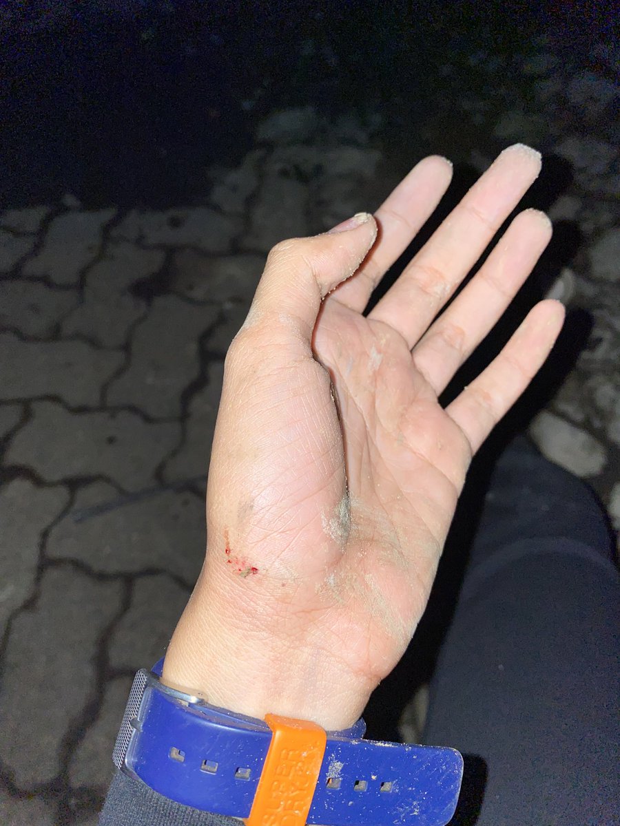 agnesiapkw's tweet photo. bnr kata beni, “ka kita letawa mulu nihari, tar mlm ada yg pgn nangis kayanya” lah iya gw jatoh dr motor tp ga nangis sih cuma meringis dikit🤣 https://t.co/PgKW2OLHLf
