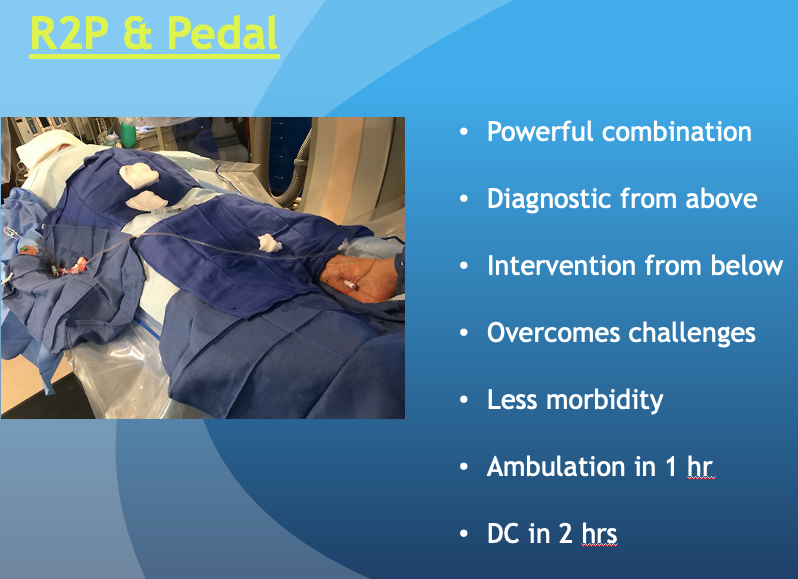 HadyLichaaMD's tweet photo. #AlternativeAccess in tough #CLI: Condensed 10min talk
https://t.co/HMDDf9Wh9R
@FadiSaab17 @kmadass @farkomd @NickMouawadMD @_backtable @drgauravgangwni @ashkan_1670 @dandu_n @SriniTummala @t_intheleadcoat @DrJayMohan @EricSecemskyMD @HashimKhan_1 @timir_paul @anishthomasmd https://t.co/fICfX8IEHc