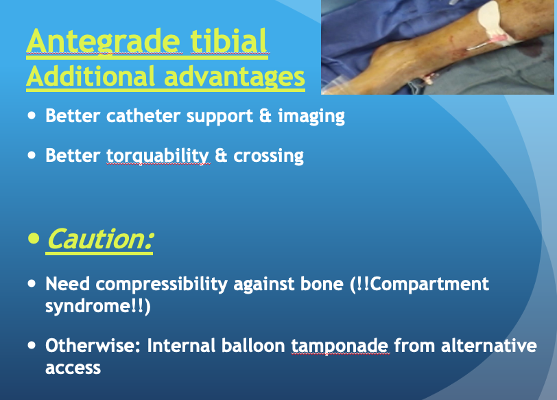 HadyLichaaMD's tweet photo. #AlternativeAccess in tough #CLI: Condensed 10min talk
https://t.co/HMDDf9Wh9R
@FadiSaab17 @kmadass @farkomd @NickMouawadMD @_backtable @drgauravgangwni @ashkan_1670 @dandu_n @SriniTummala @t_intheleadcoat @DrJayMohan @EricSecemskyMD @HashimKhan_1 @timir_paul @anishthomasmd https://t.co/fICfX8IEHc