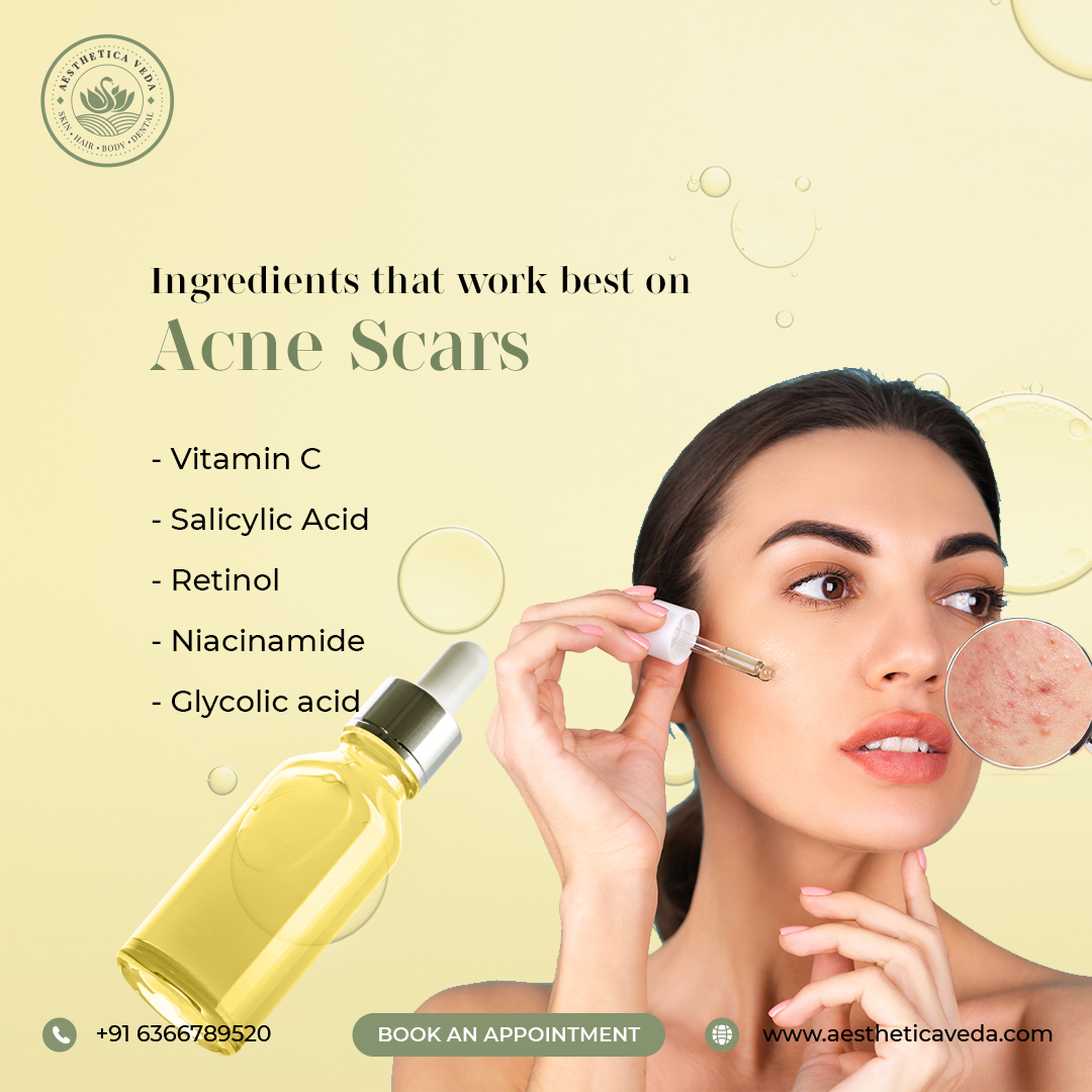 AestheticaVeda's tweet photo. While we can't fade acne scars overnight, here's a quick brief of super ingredients to consider in your skincare routine.
Contact our Expert Dermatologist in Bangalore @AestheticaVeda
#aestheticveda #comestic #dermatology #haircare #dental #clinic #enterpreneur #business https://t.co/68jsDbvI0J