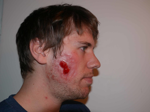 JuanPascual4's tweet photo. 1/ La leishmaniosis es una enfermedad que afecta a perros, gatos y a las personas. Muy presente en la cuenca mediterránea.
Te cuento su causa, su historia, su epidemiología.
Puede curarse y prevenirse.
La leishmaniosis, abro hilo: 👇👇👇 https://t.co/QzsjaQeNGH