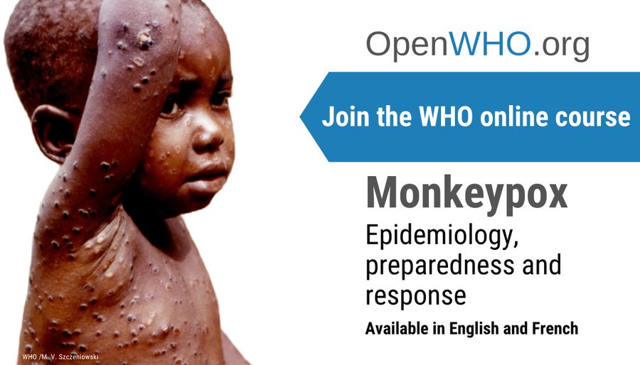 European outbreak of monkeypox: what you need to know