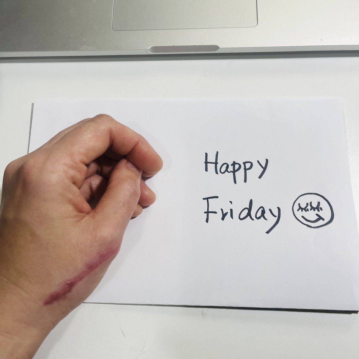 urbanplusforest's tweet photo. Happy Friday!  #HappyFriday #birch #hand #injury #NFTProject #nftcollectors #NFTartist #etsy #fundraiser https://t.co/seGgM0ZM4w