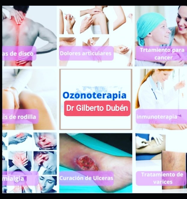 duben_dr's tweet photo. Qué es la ozonoterapia?
La ozonoterapia es el empleo del Ozono Médico como medicamento biológico, apto y seguro para ser aplicado en el tratamiento de dolor crónico y de numerosas enfermedades, todas ellas en relación con el daño celular por exceso de radicales libres. https://t.co/EjYxPIpuNb