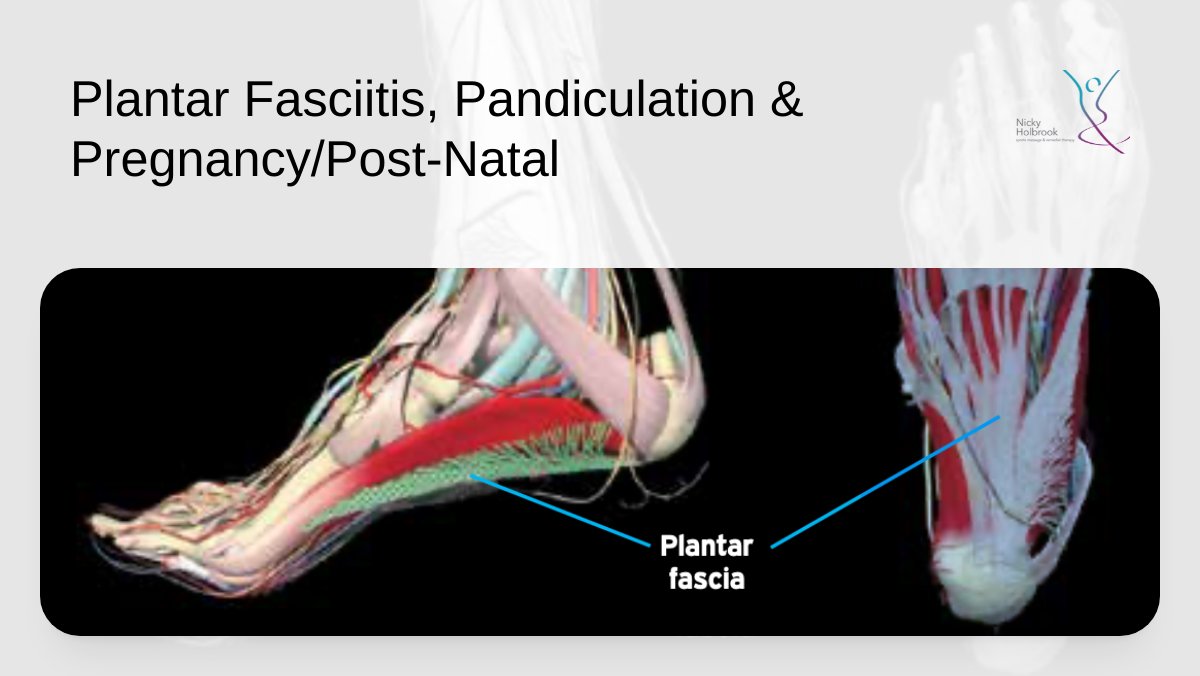 Oops - corrected email with a working link to read about Plantar Fasciitis - The 3 P's - mailchi.mp/189560b5f868/t…