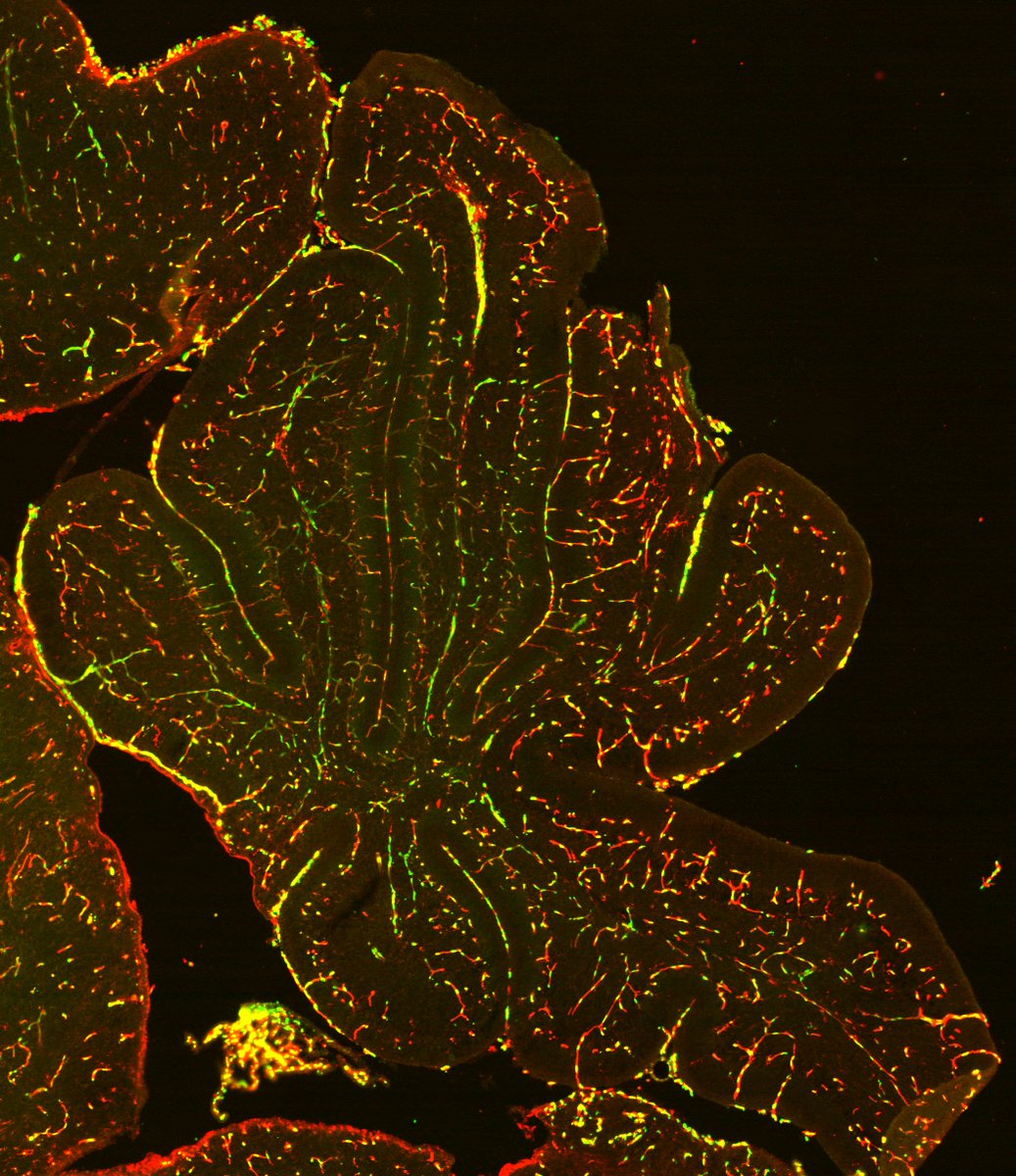 Neurobiology Imaging Facility at Harvard Medical (@hms_nif) on Twitter photo Have you entered our imaging contest yet?
Details here: nif.hms.harvard.edu/news/236
-
Check out this image from our previous contest.
By Swathi Ayloo <a href="/GuLabNeuro/">The Gu Lab</a>
#VS120 Slide Scanner
The image is a snapshot of blood vessels in the cerebellum of a 10 day old mouse. Have you entered our imaging contest yet?
Details here: nif.hms.harvard.edu/news/236
-
Check out this image from our previous contest.
By Swathi Ayloo <a href="/GuLabNeuro/">The Gu Lab</a>
#VS120 Slide Scanner
The image is a snapshot of blood vessels in the cerebellum of a 10 day old mouse.