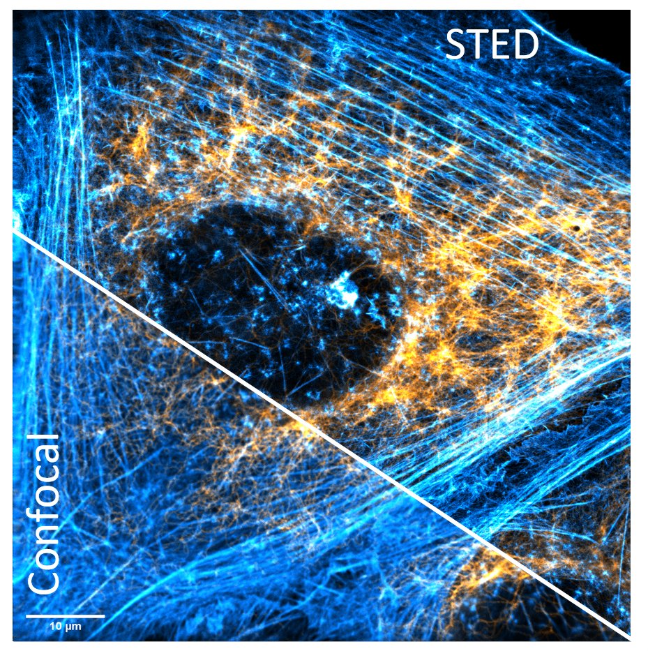 So proud that the students have taken such beautiful images like this one by themselves during the imaging course. Thank you so much for your participation! #Microscopy #STED #FluorescenceFriday <a href="/GGNBTimes/">GGNB Times</a>