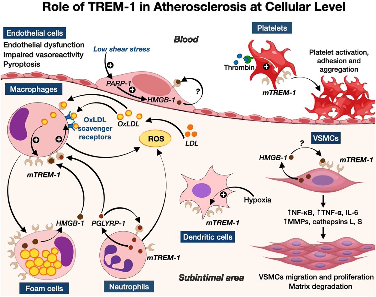 SaurabhiSamant's tweet photo. A potential pivotal target in atherosclerosis- TREM-1. Thank you @acpanagopoulos for this amazing collaboration and @YChatzizisis for the mentorship. https://t.co/VtC7neLShg https://t.co/x1aOwYtKYv