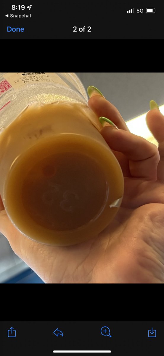 squavvy_'s tweet photo. @dunkindonuts beware of metal shavings making their way into cups https://t.co/qgMwhJByvP