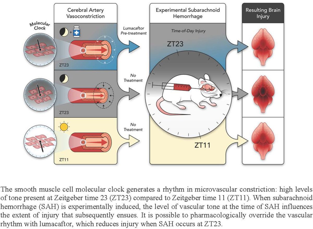 StrokeAHA_ASA's tweet photo. #BloggingStroke: Microvascular Circadian Rhythmicity and Subarachnoid Hemorrhage-Induced Injury https://t.co/WWo88UZLZ3
In this blog post, @KShkirkova discusses #Stroke article https://t.co/wBzOblA4dd https://t.co/arNAjuSnbx