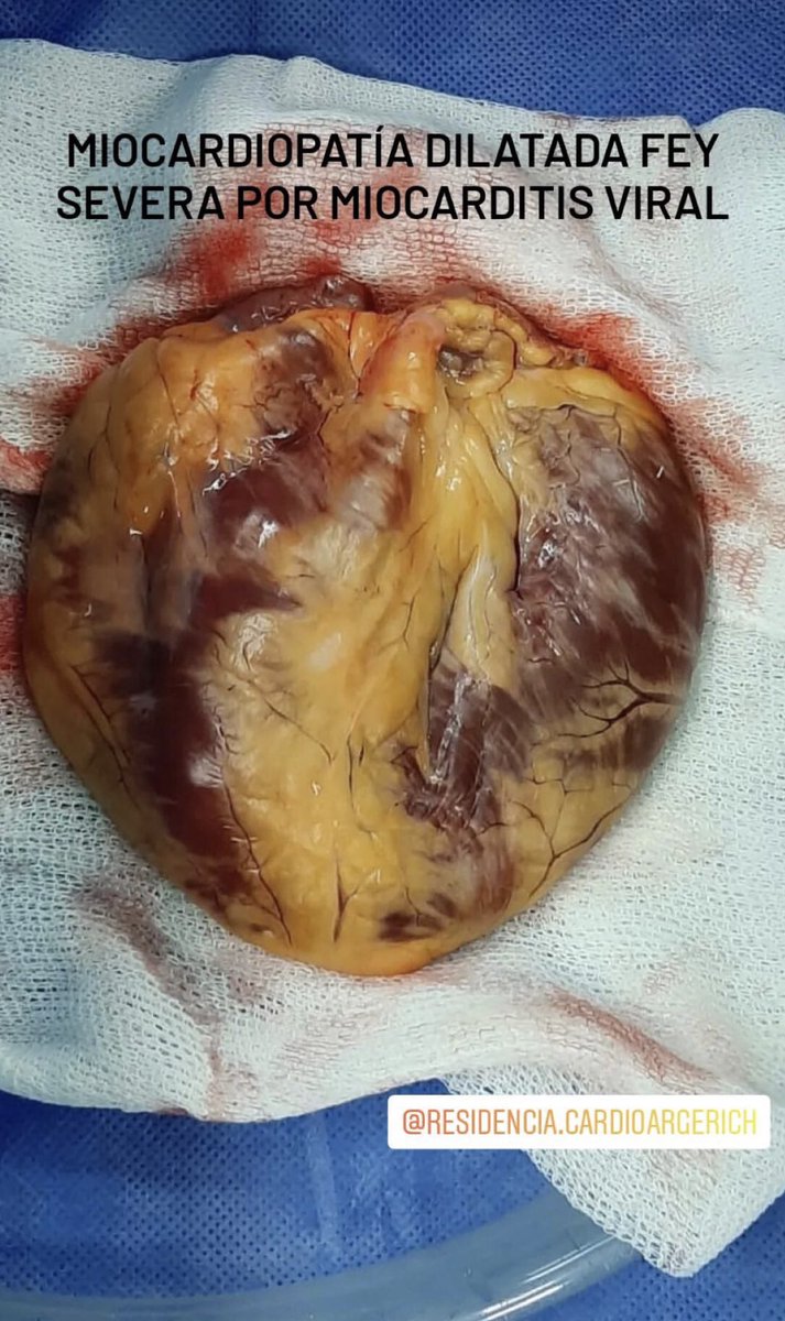 Residencia de Cardiología Hospital Cosme Argerich tweet media