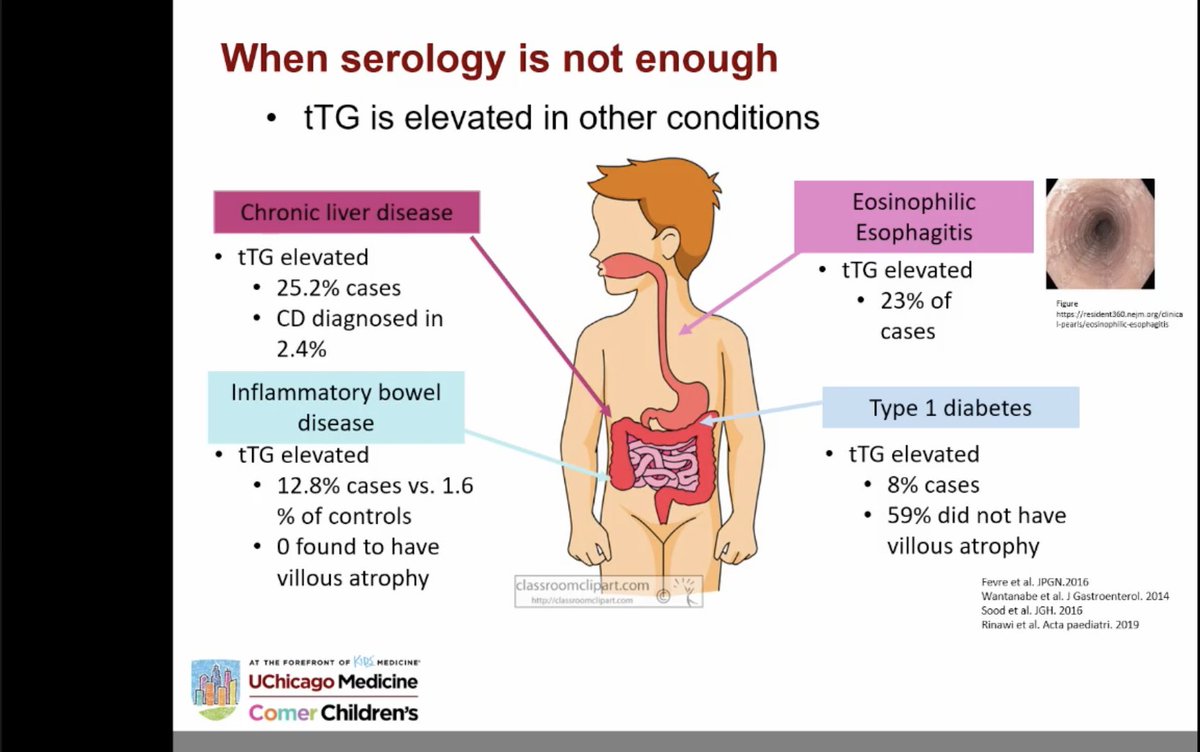 elevated TTG seen in MANY other diseases, not just #celiac. The role of biopsy by <a href="/RituVermaMD/">Ritu Verma</a> #ColumbiaCeliac #CeliacintheCity