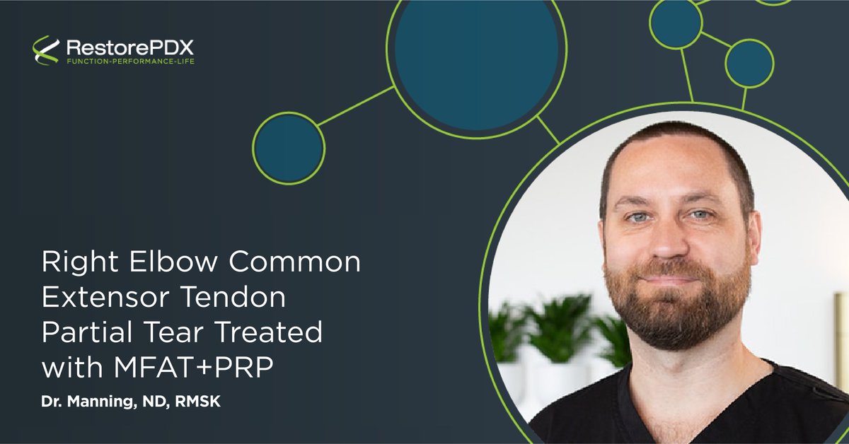 #Elbowpain has many causes and often wear and tear over time can lead to certain types of arthritis, tendinopathy, and stress fractures. In this video, Dr.Manning walks us through a successful patient outcome involving ultrasound-guided #PRPinjections:restorepdx.com/uncategorized/…