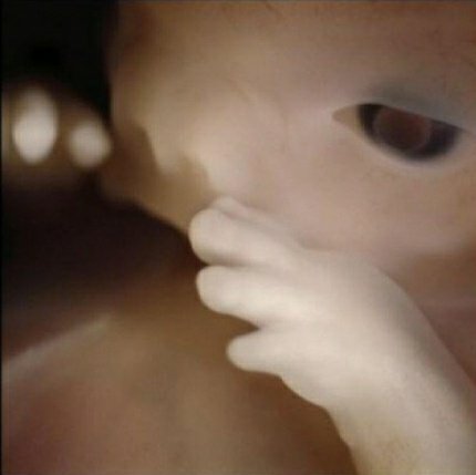 ATOMEE__'s tweet photo. Ces photos de fœtus ont été prises directement dans l'utérus.

Fascinant 😯 https://t.co/LGYSclz4U8