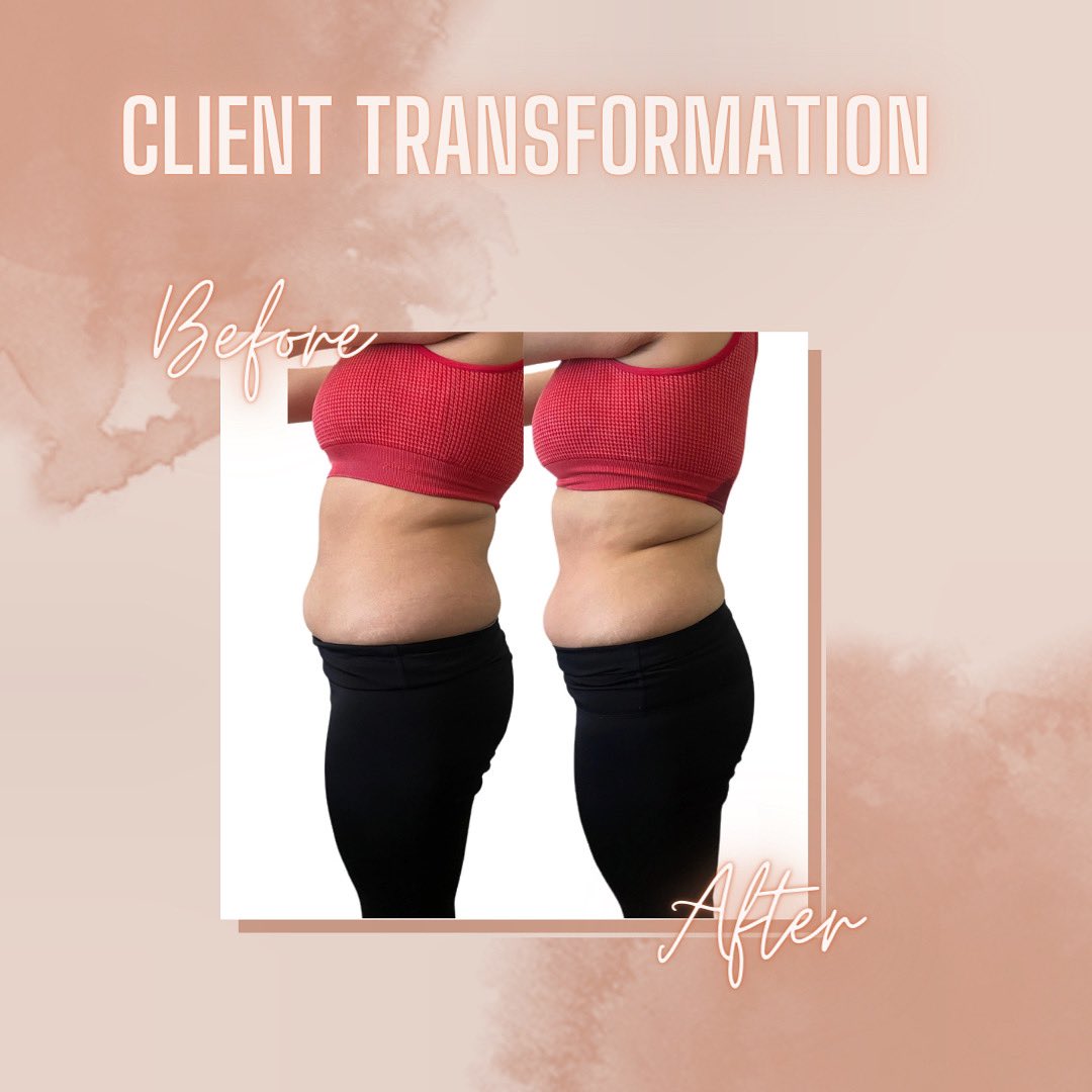 reduce bloating and get a flatter tummy with me, naturally ✨
•
#bodyscultping #bodypositivity #bodysculptor #bodyscultpingtexas #radiofrequency