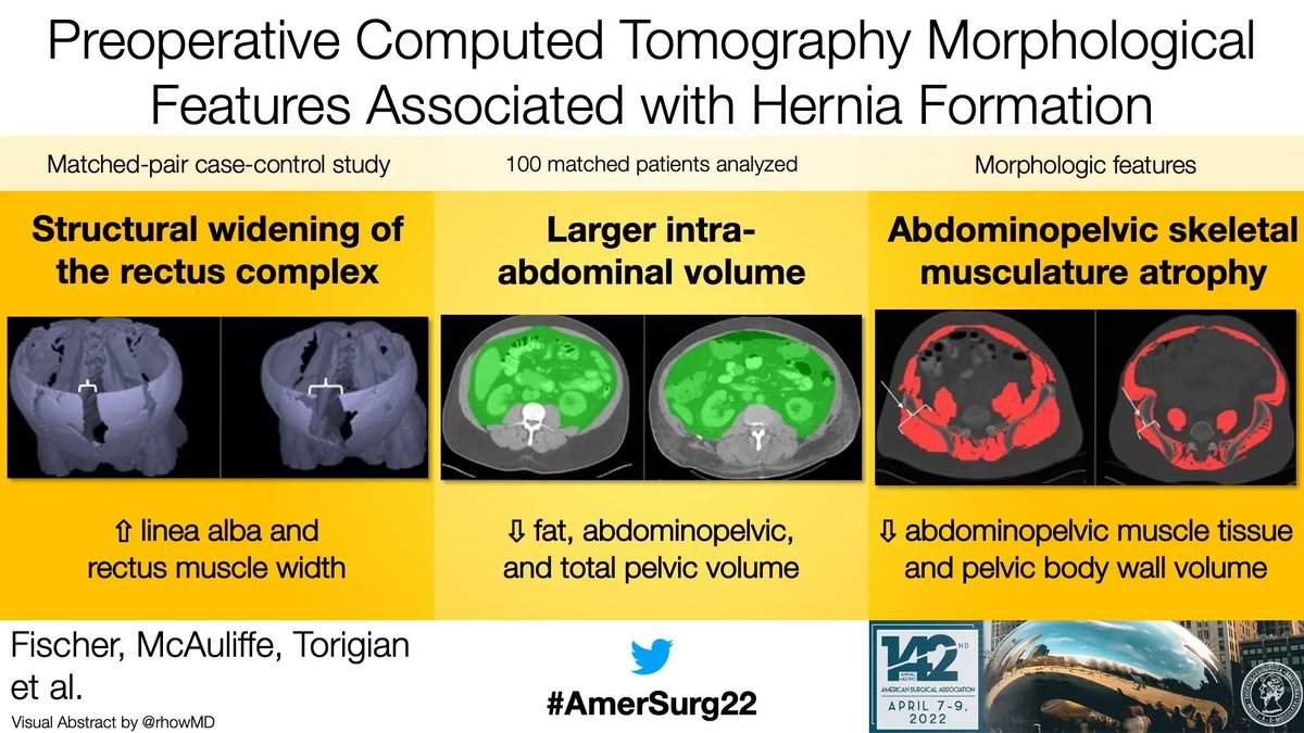 Annals of Surgery tweet media