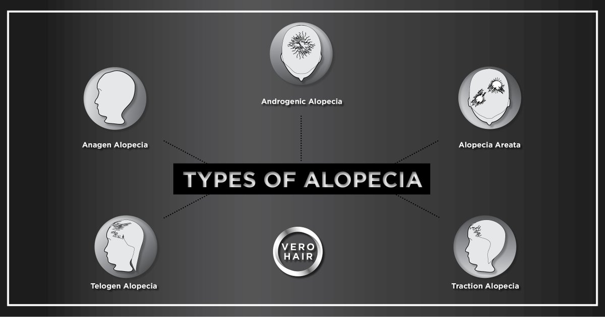 neograft's tweet photo. With all the recent discussion on female alopecia, we want to highlight @drwolfeld’s work on female hair loss. Head to https://t.co/dsvaYt5xtc to watch Inside Edition’s video on female alopecia and hear Dr. Wolfeld’s comments on female pattern hair loss.

#ARTAS #NeoGraft #VERO https://t.co/7HYBFqLE02