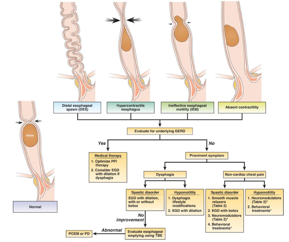 Looking for one paper to summarize how to diagnose & treat all the different esophageal motility disorders? Here is a tweetorial on all the highlights from our recent publication (along w/ @RenaYadlapati) in @AGA_Gastro! @AmerGastroAssn #GITwitter doi.org/10.1053/j.gast…