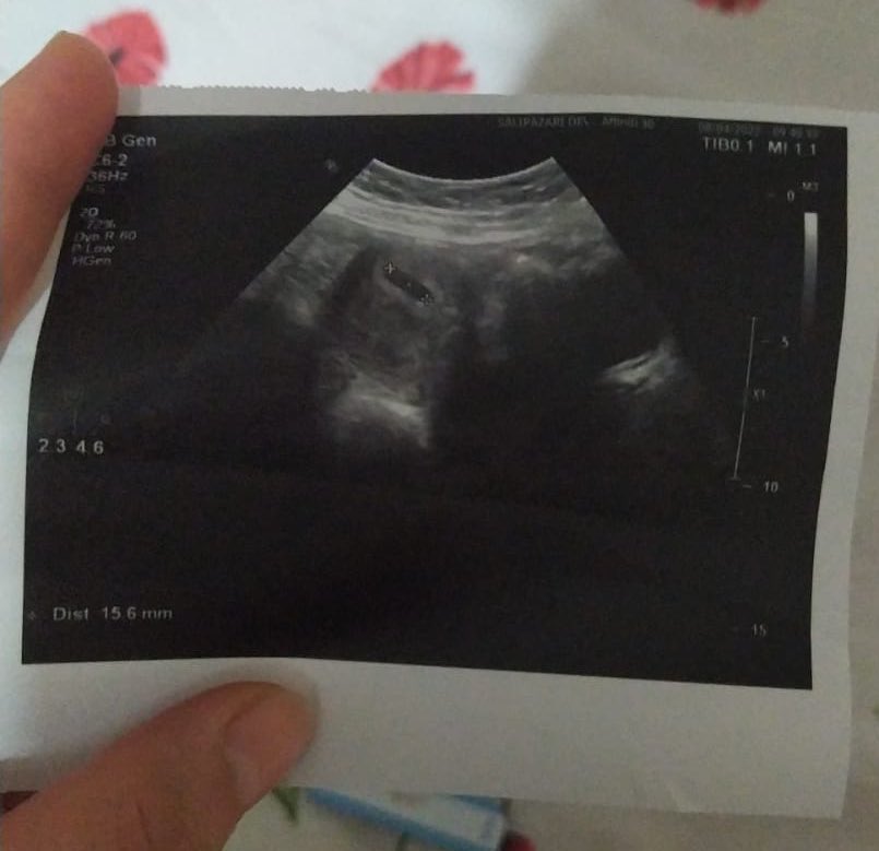 Arkadaşlar ben teyze oluyoruuuummmm 😍💜