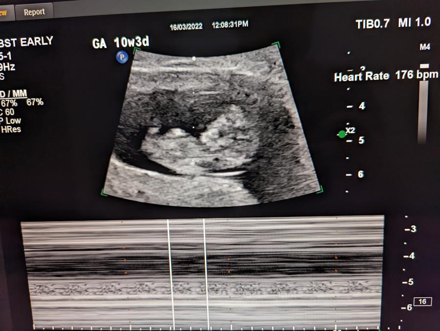 Beyond | Brad tweet media