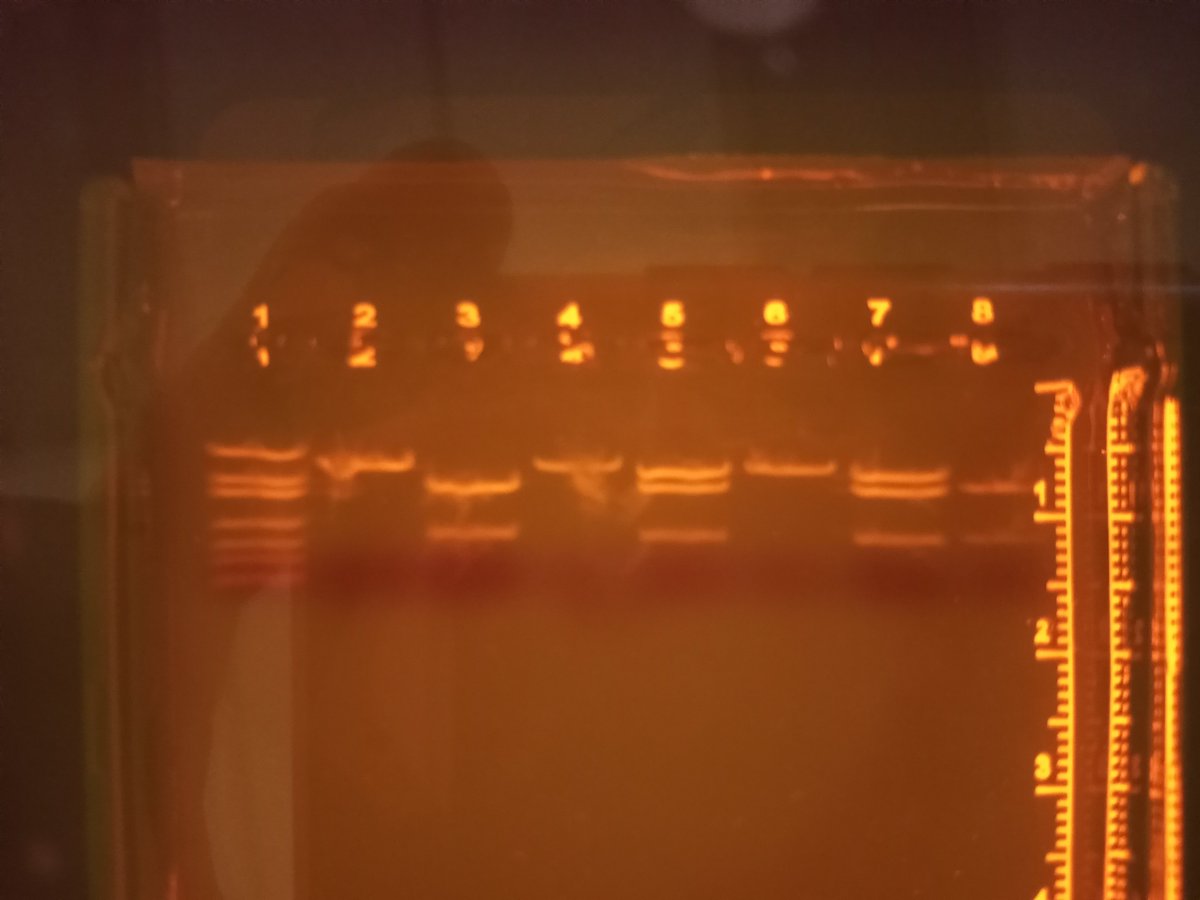 ErhsPltw's tweet photo. PLTW Biomedical 9th graders genetically testing patients for familial hypercholesterolemia gene via gel electrophoresis! @ElRanchoHS https://t.co/5hYNHfCryv