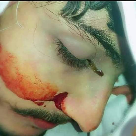 IEAUrduOfficial's tweet photo. ابابیل کا تعلق ننگرھار سے تھا میدان وردگ میں شہید ہوئے،اپنے علاقے لے جانا مشکل تھا تو وہیں دفنا دیا
والد کو خبر ہوئی وہ قبر پر آئے بضد رہے کہ قبر کھولی جائے
دو ماہ بعد قبر کھولی گئی تو ابابیل تروتازہ تھا
وہاں موجود ہر شخص کے آنسو جاری ہوئے اس دوران شہید کے بھی آنسو جاری ہوگئے https://t.co/CQTZtXmvKk