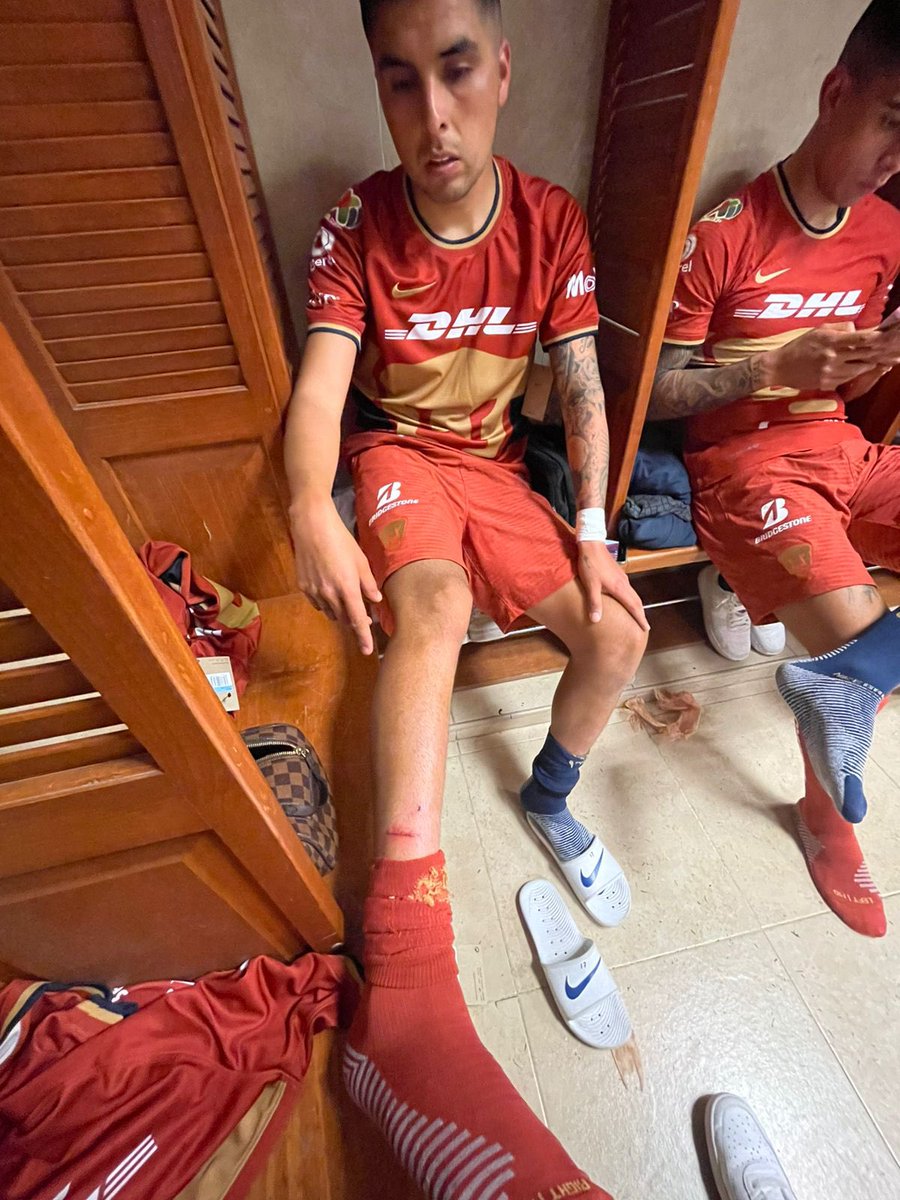 Alonso_Cabral's tweet photo. Así quedó Leo López de #Pumas.
Ustedes juzguen… 

Hace pocas jornadas a Mozo lo expulsaron por una idéntica, ahora solo fue amarilla… 

@TUDNMEX https://t.co/rmeWWQav8Q