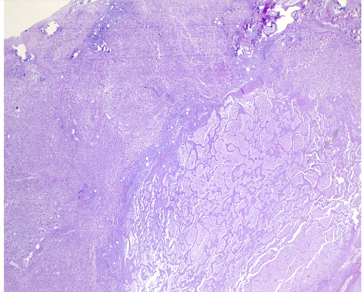 Willy Kemp tweet media