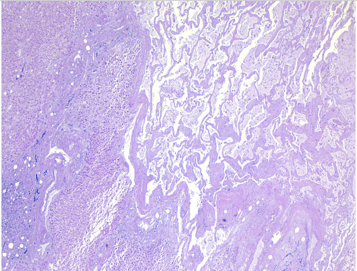 Willy Kemp tweet media