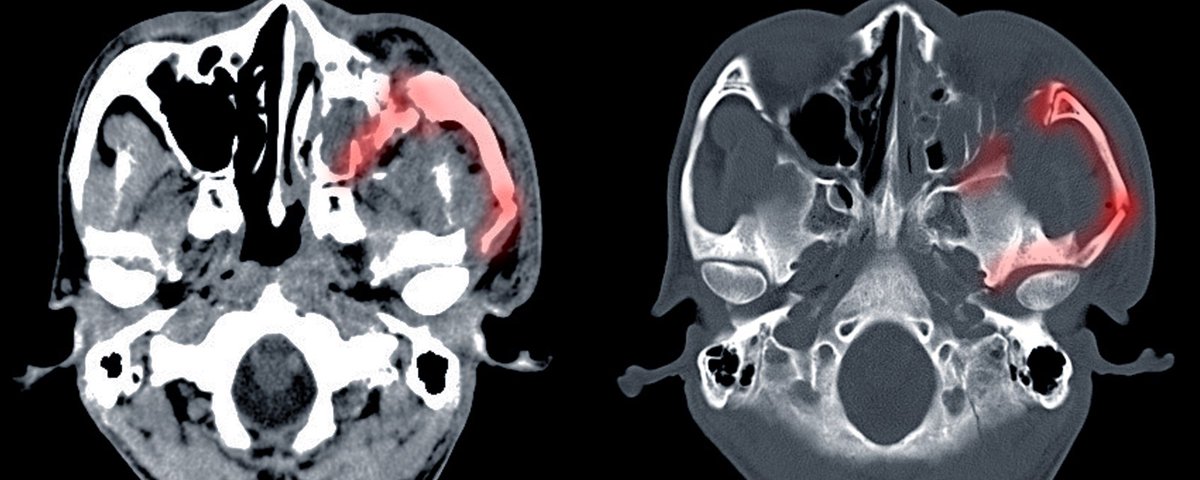 🔹UMAX 2022 conference showcases Oral and Maxillofacial Surgery as a speciality and as a postgraduate career choice, by <a href="/RoySocMed/">The Royal Society of Medicine</a> 

🔸rsm.ac.uk/events/oral-an…

🗓️Sat 23 Apr 2022⌚️8:30am to 4:30pm