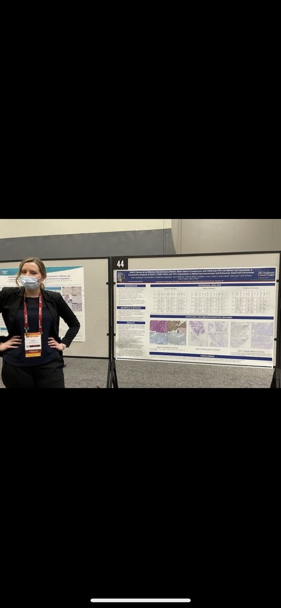 KaitVanderbeck's tweet photo. A bit late, but had a wonderful time at #USCAP2022 presenting our research about SOX11 expression in Merkel cell carcinoma! @DrPhyuPAung2 @DrAldehyde @AimiTRothrockMD @TorresCabalaMD @vgprieto14 @LeiSun17635272 @PNagarajanMDACC! #pathtwitter #dermpath https://t.co/sIGCpbGEsc