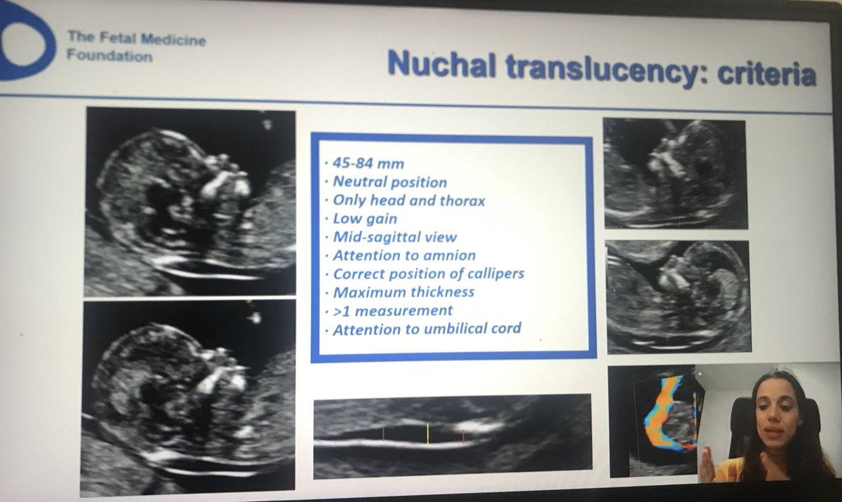rsog_rwanda's tweet photo. ULTRASOUND is an essential tooli used in the Management of Both Obstetrical &amp; Gynecological conditions #RSOG members through partnership with @ISUOG #FMfoundation are attending the US Course This will enable our members 2 help better their Patients @ngogaeu @GHertier @FIGOHQ https://t.co/pyWtjKdsov
