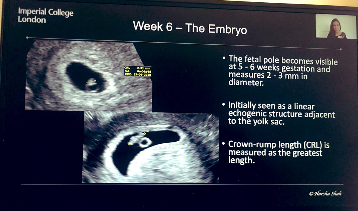 rsog_rwanda's tweet photo. ULTRASOUND is an essential tooli used in the Management of Both Obstetrical &amp; Gynecological conditions #RSOG members through partnership with @ISUOG #FMfoundation are attending the US Course This will enable our members 2 help better their Patients @ngogaeu @GHertier @FIGOHQ https://t.co/pyWtjKdsov