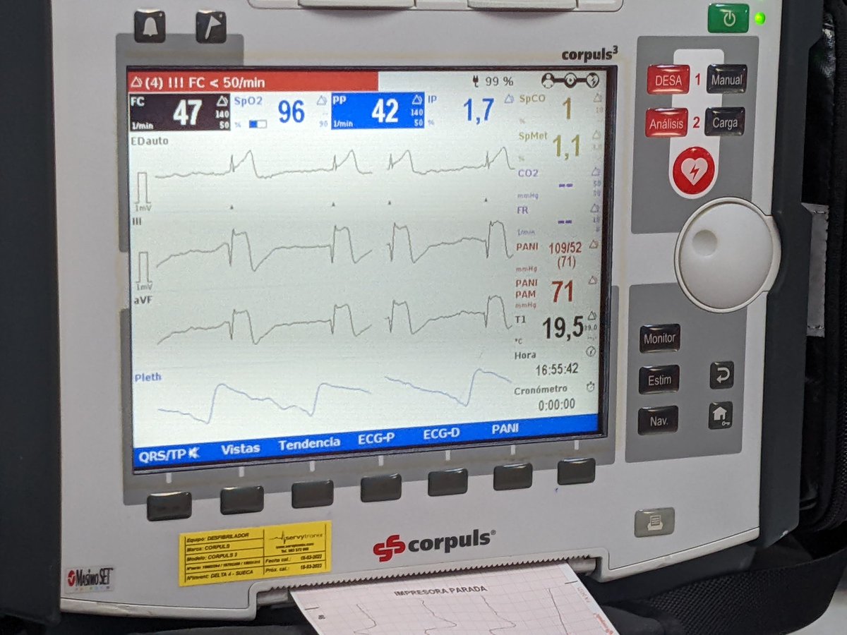 Otro interesante de nuestras guardias temáticas...
Paciente con trasplante cardíaco hace 13a que inicia con mareo, sudoración y malestar y acude a urg en taxi... 
Nos activan para ICP primaria urgente.