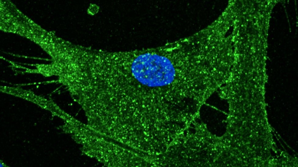 MozartCircle's tweet photo. #MozartCircleScience
8 April 2022
@BabrahamInst, based on 2012 @NobelPrize #ShinyaYamanaka discovery on turning #NormalCells into #StemCells, managed to get the #Rejuvenation of 53yo Woman's skin into a 23yo Young Woman's skin!
#ff https://t.co/rtwnGvlJbm
https://t.co/Y65seL1tmB https://t.co/4zH40pePu5