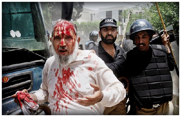 RanaDanish92's tweet photo. 14000 piles of photographic evidence have been piled up yet why the murderers of Model Town tragedy were not put in jail????
#SupremeCourt
#امپورٹڈ_حکومت_نامنظور
#SilenceOnMTcase https://t.co/YCjGGgNedV