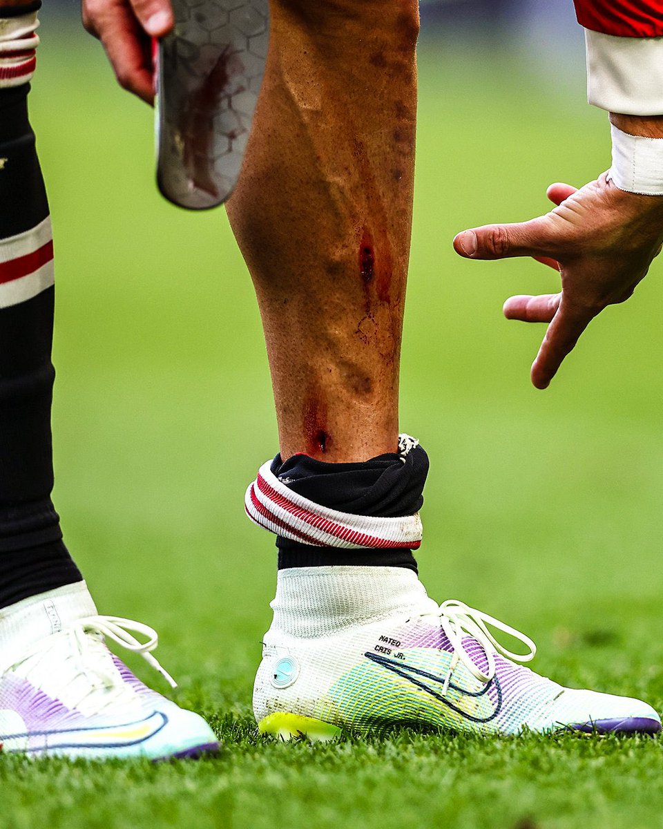 utdreport's tweet photo. Cristiano Ronaldo’s leg 😳 https://t.co/abPxSw9t2B