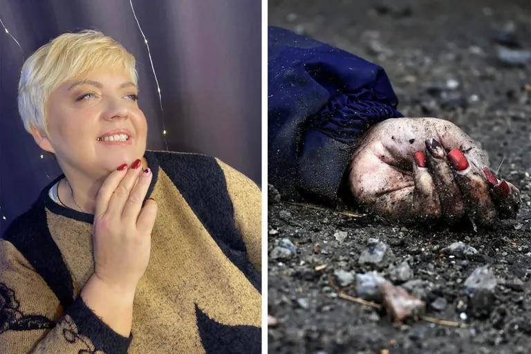 LANACION's tweet photo. Guerra Rusia-Ucrania: la historia de vida detrás de las uñas pintadas en una víctima de la masacre de Bucha https://t.co/yTcvIal13w https://t.co/8xz71a0dNg