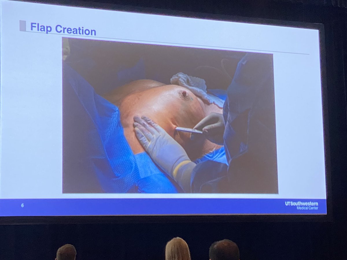 Love this - robotic nipple sparing mastectomy and immediate breast reconstruction. Huge benefits for the patient, resident training and surgical ergonomics for the surgeon #ASBrS22