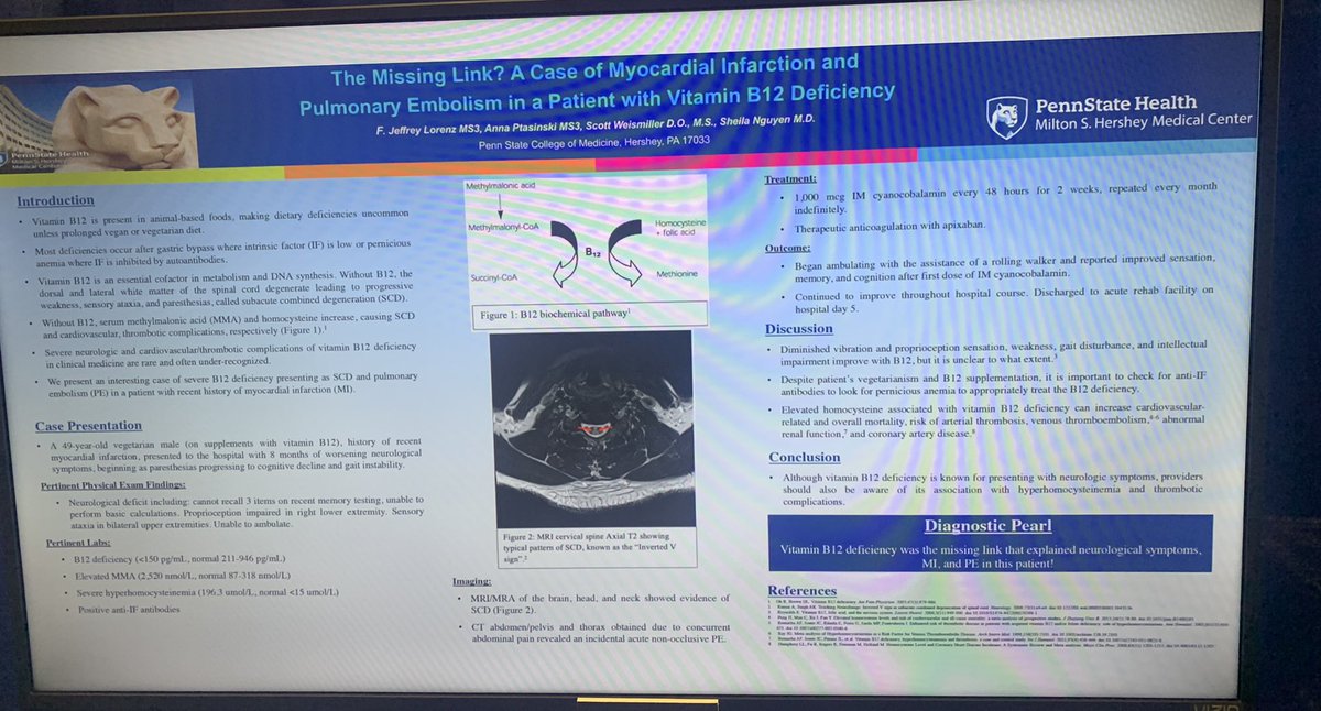 Jeff Lorenz (@lorenzjeff12) on Twitter photo Another great day at #SHMConverge! Presented a case of subacute combined degeneration and PE in a patient with recent MI. All explained by severe vitamin B12 deficiency and elevated homocysteine. <a href="/aptas5/">Anna Ptasinski</a> Another great day at #SHMConverge! Presented a case of subacute combined degeneration and PE in a patient with recent MI. All explained by severe vitamin B12 deficiency and elevated homocysteine. <a href="/aptas5/">Anna Ptasinski</a>