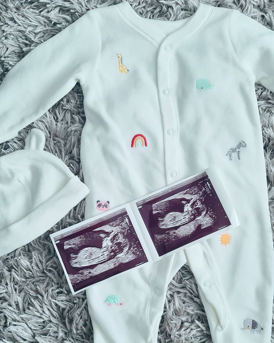 LibbieLB's tweet image. We can't wait to meet you little one 👶🏼 not long till we find out if you are team blue or pink 😍 #babyno2 #pregnant