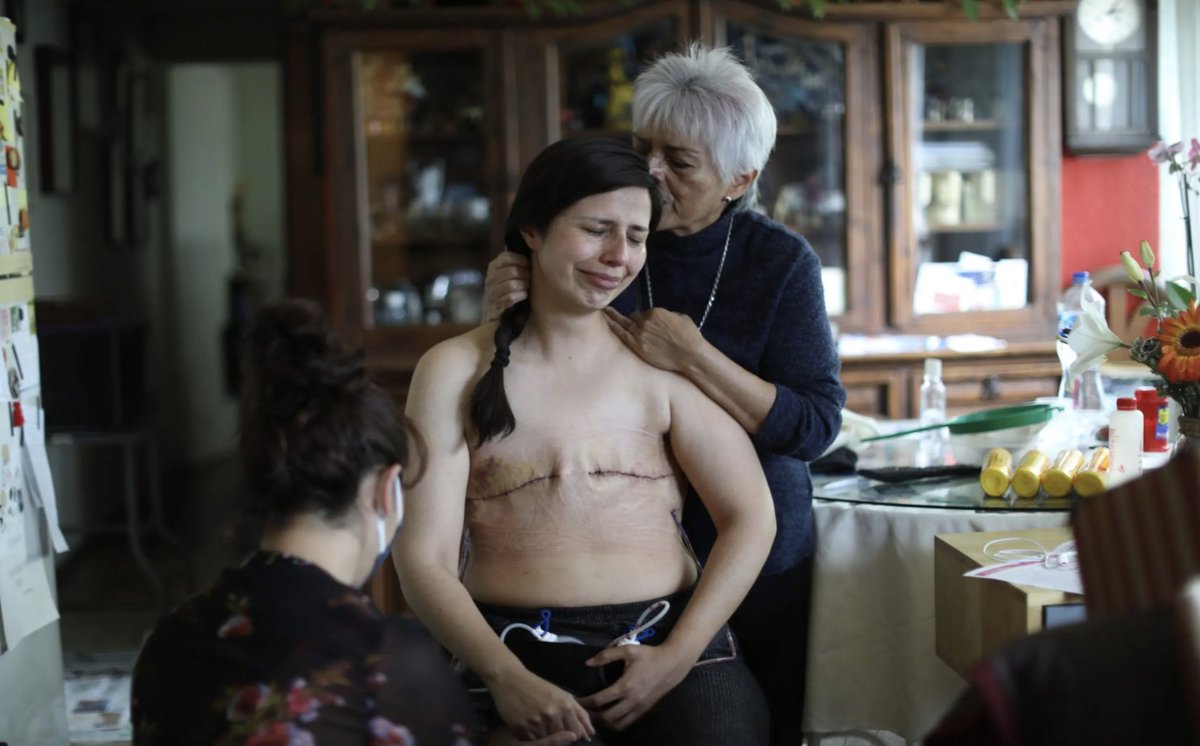 AristeguiOnline's tweet photo. Fotógrafa mexicana recibe premio Ortega y Gasset; la imagen muestra a Sandra Monroy, paciente de cáncer que tuvo una mastectomía bilateral. https://t.co/XeUVumYBsX https://t.co/TZ40dSBDQO
