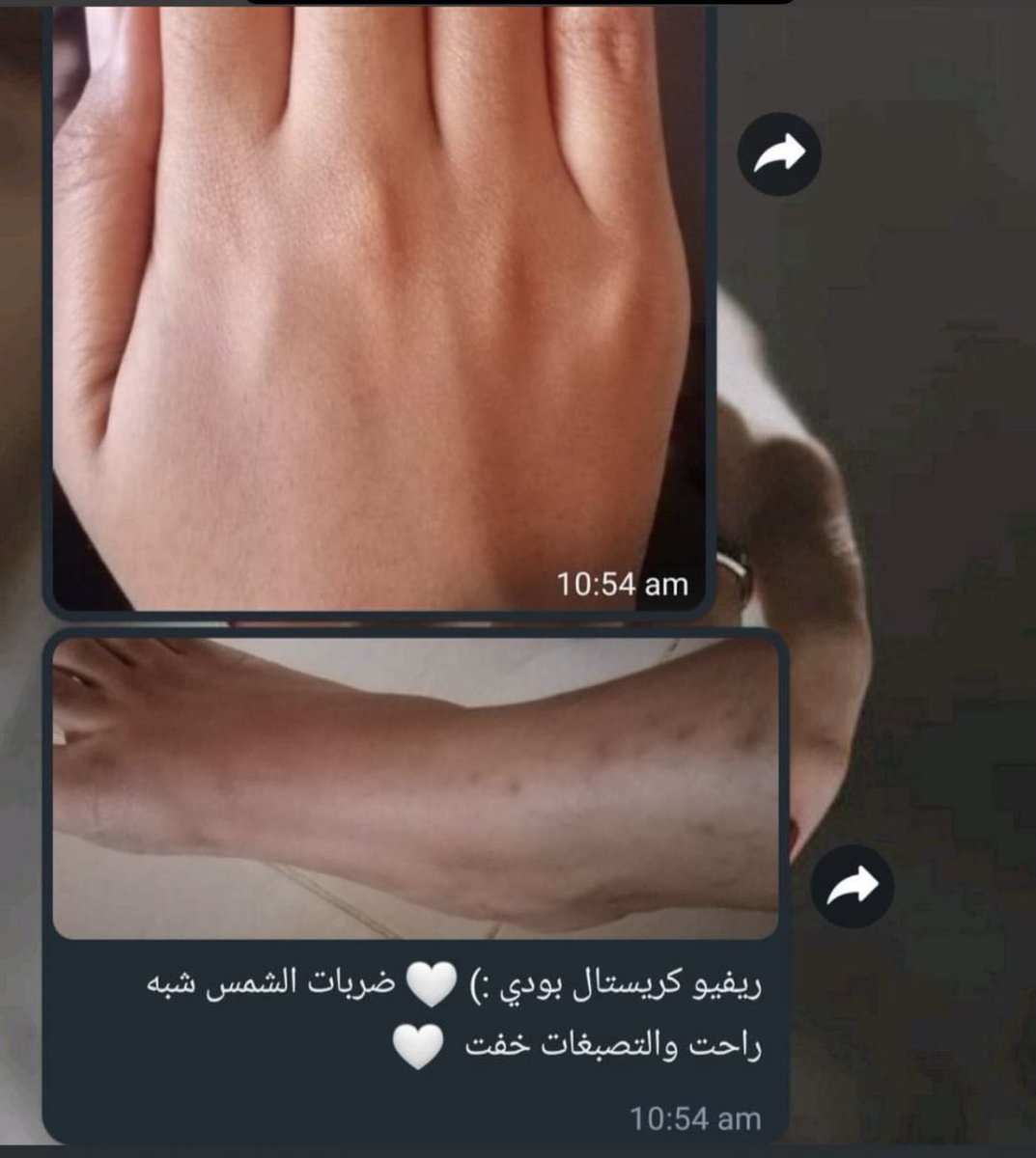 shineandglowcos's tweet photo. سحب رمضان 😍🌙

سحب على ٢ كريستال بودي كريم لبنتين.. الكريم لتوحيد لون الجسم، ازالة الاثار و التصبغات، ضربات الشمس، الترطيب العميق و ازالة الجلد الميت و بعمل نضارة عالية جدا❤️

الشروط:
لايك،ريتويت،فولو و اكتبي لينا رمضان كريم في كومنت، ح نرد عليك ب الله اكرم انتي الفايزة معانا ❤️ https://t.co/ke0SudJP4f