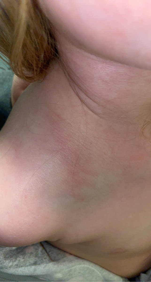 gabs_2015's tweet photo. Seeing your child in pain and you can't take it away is the absolute worst!!! Prayers for my baby girl as we await to see if she has to have surgery 💔😭😭 https://t.co/OFo0Kgt4RC