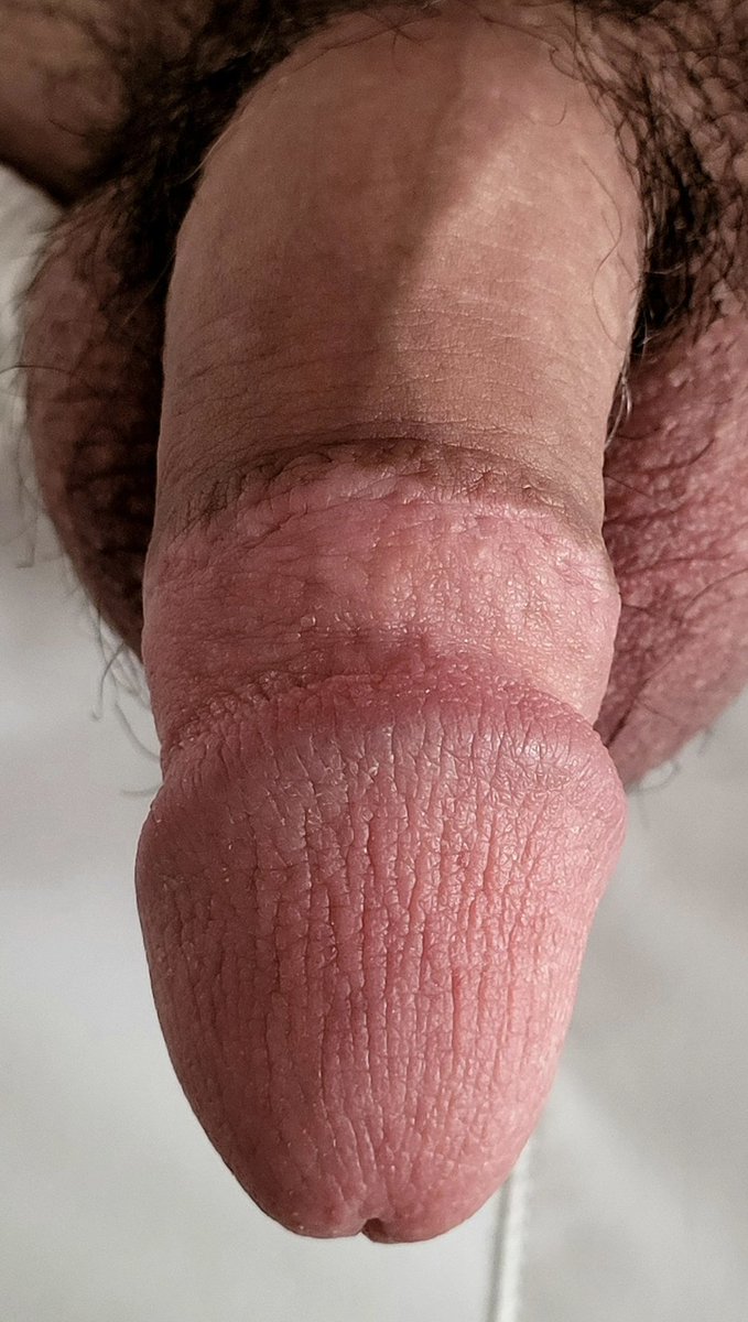 Amazing scar 😍